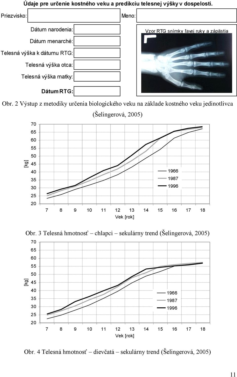 2 Výstup z metodiky určenia biologického veku na základe kostného veku jedinotlivca (Šelingerová, 2005) Obr.