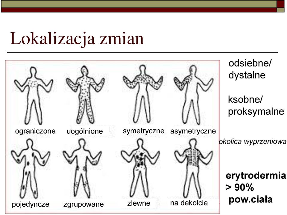 asymetryczne okolica wyprzeniowa pojedyncze