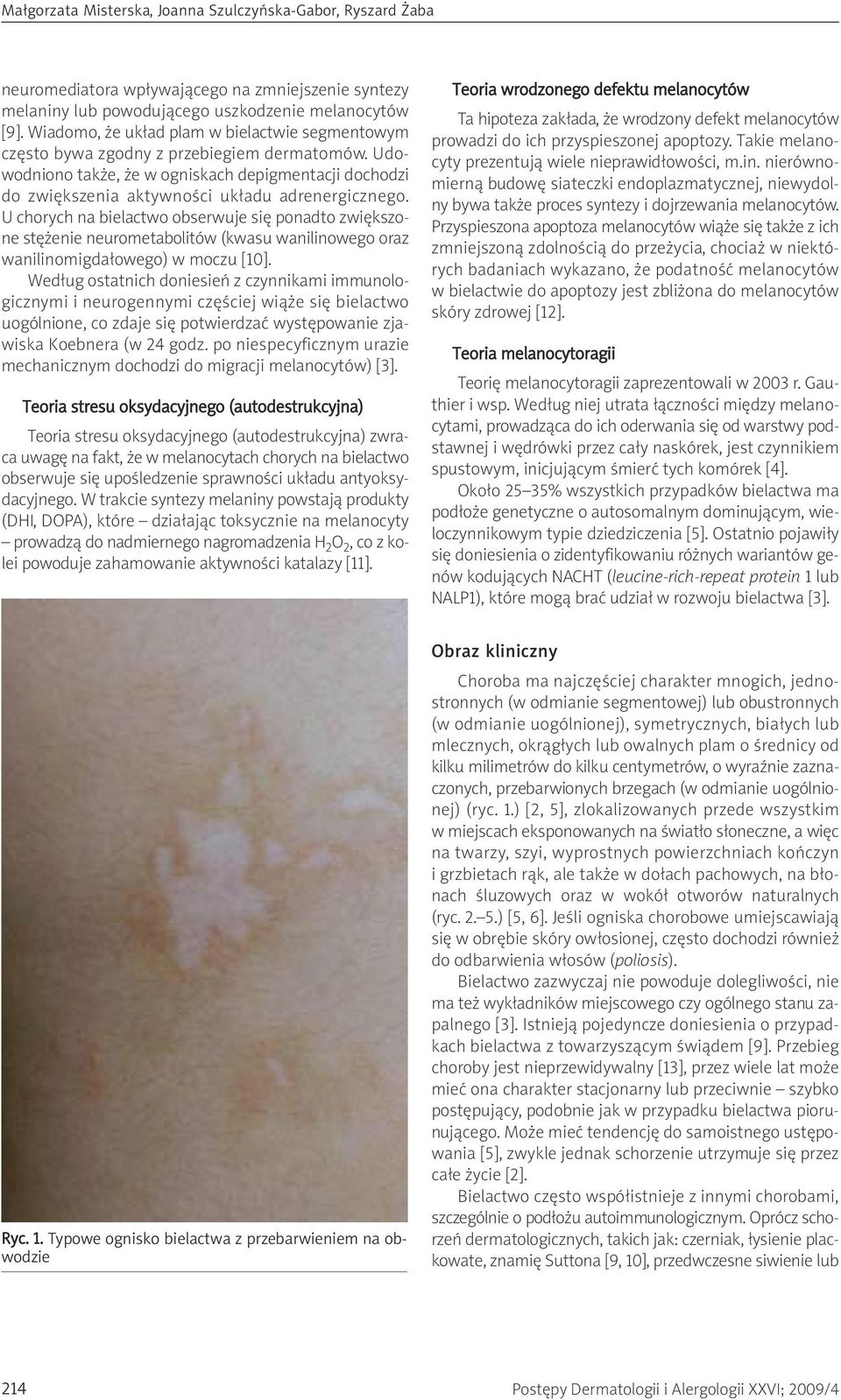 U chorych na bielactwo obserwuje się ponadto zwiększone stężenie neurometabolitów (kwasu wanilinowego oraz wanilinomigdałowego) w moczu [10].