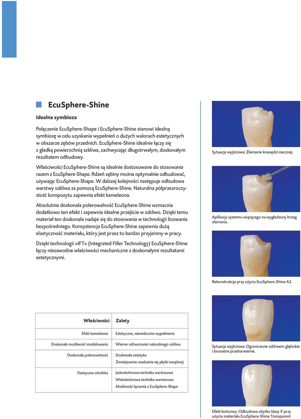 Właściwości EcuSphere-Shine są idealnie dostosowane do stosowania razem z EcuSphere-Shape. Rdzeń zębiny można optymalnie odbudować, używając EcuSphere-Shape.