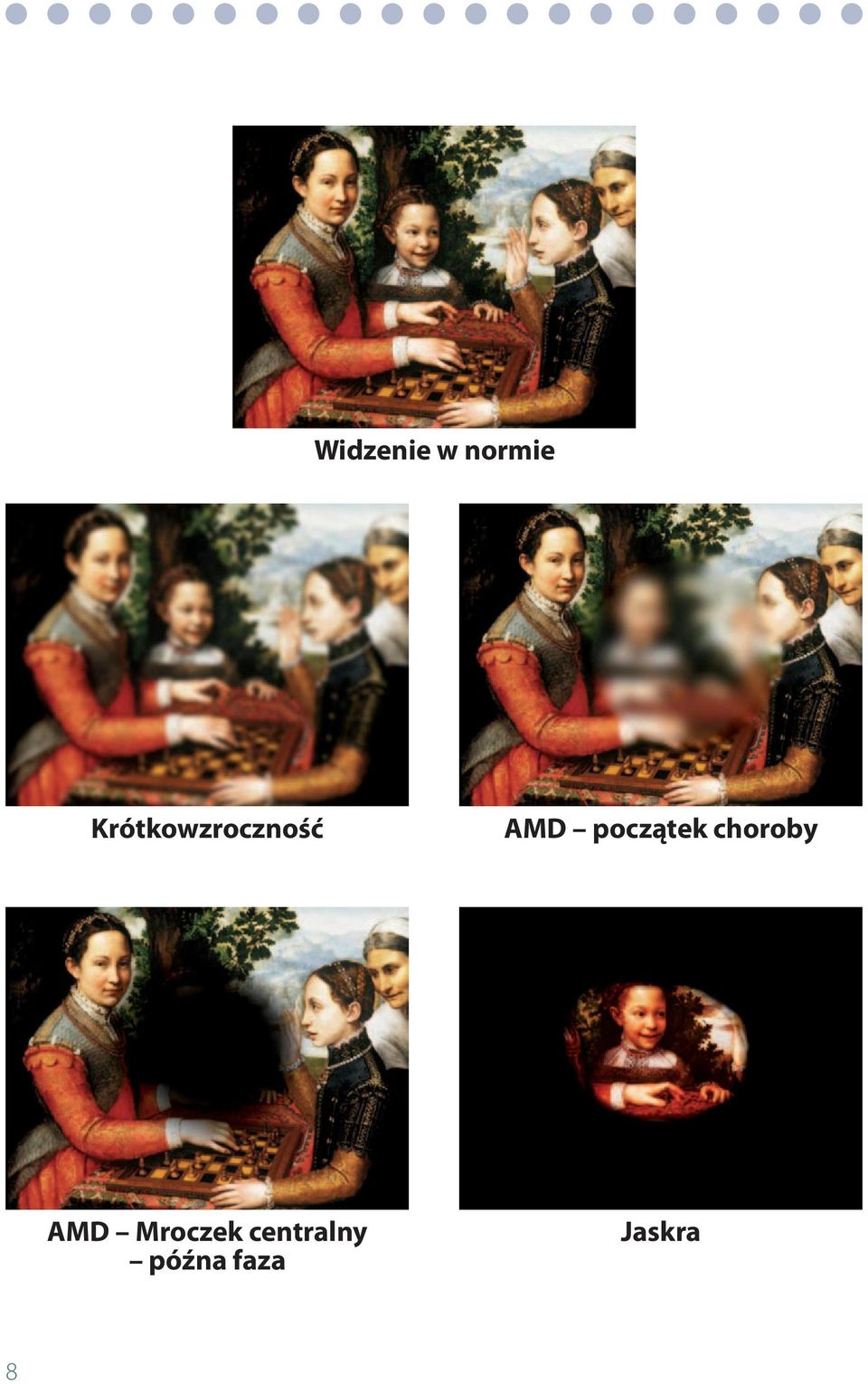 początek choroby AMD