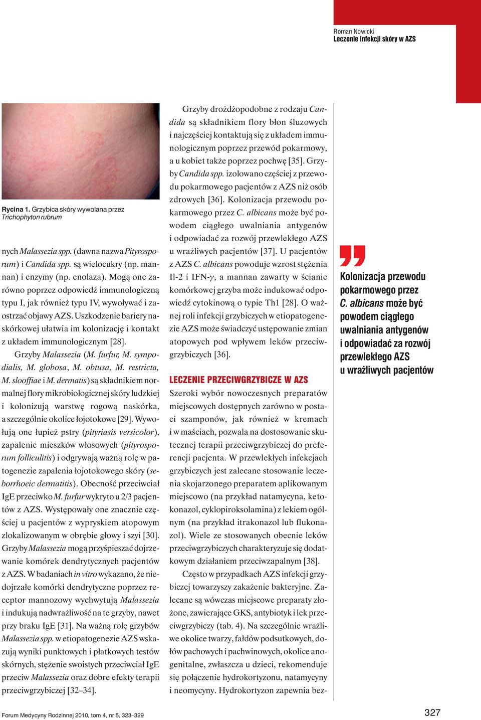 Uszkodzenie bariery naskórkowej ułatwia im kolonizację i kontakt z układem immunologicznym [28]. Grzyby Malassezia (M. furfur, M. sympodialis, M. globosa, M. obtusa, M. restricta, M. slooffiae i M.