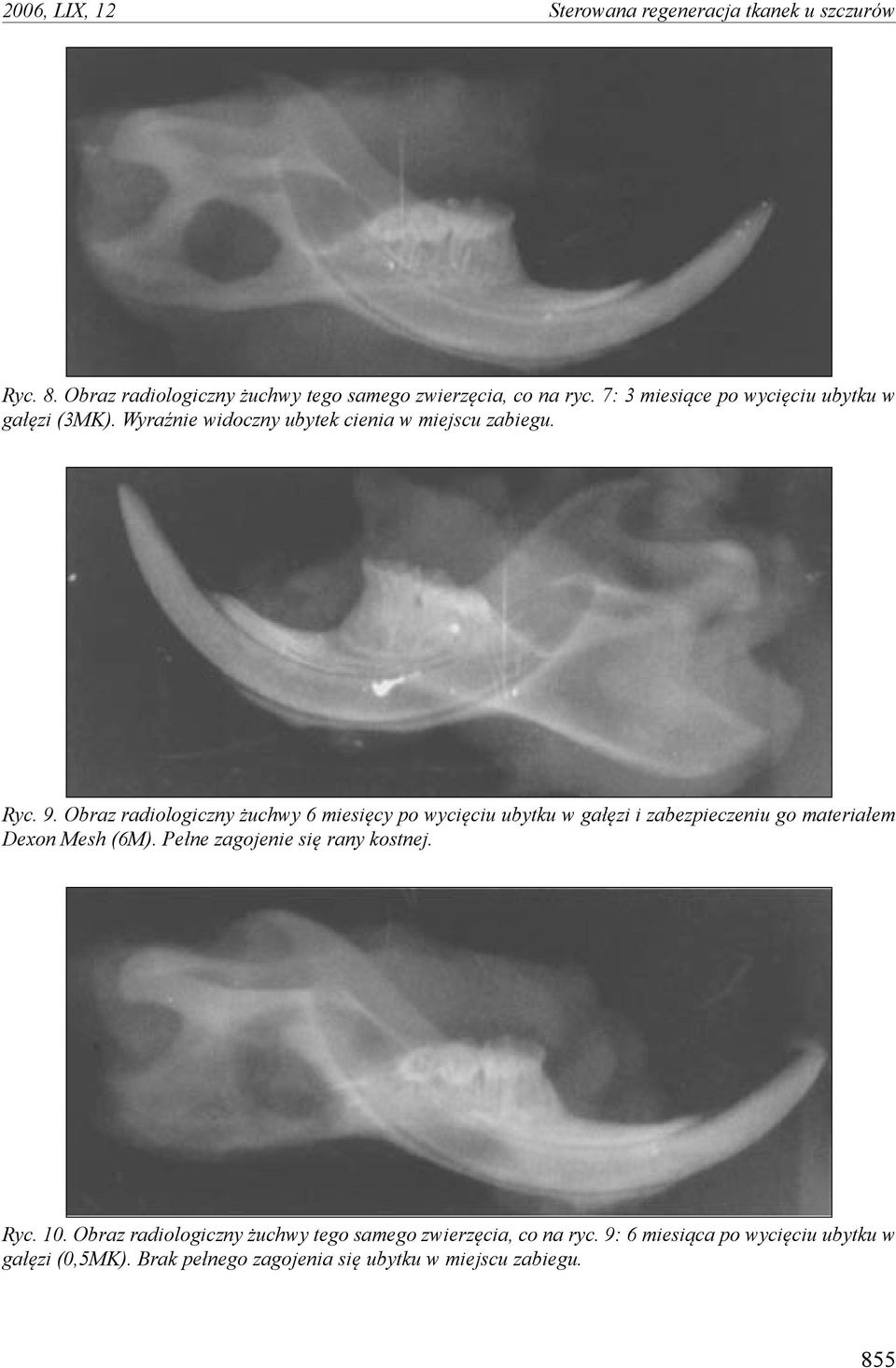 Obraz radiologiczny żuchwy 6 miesięcy po wycięciu ubytku w gałęzi i zabezpieczeniu go materiałem Dexon Mesh (6M).