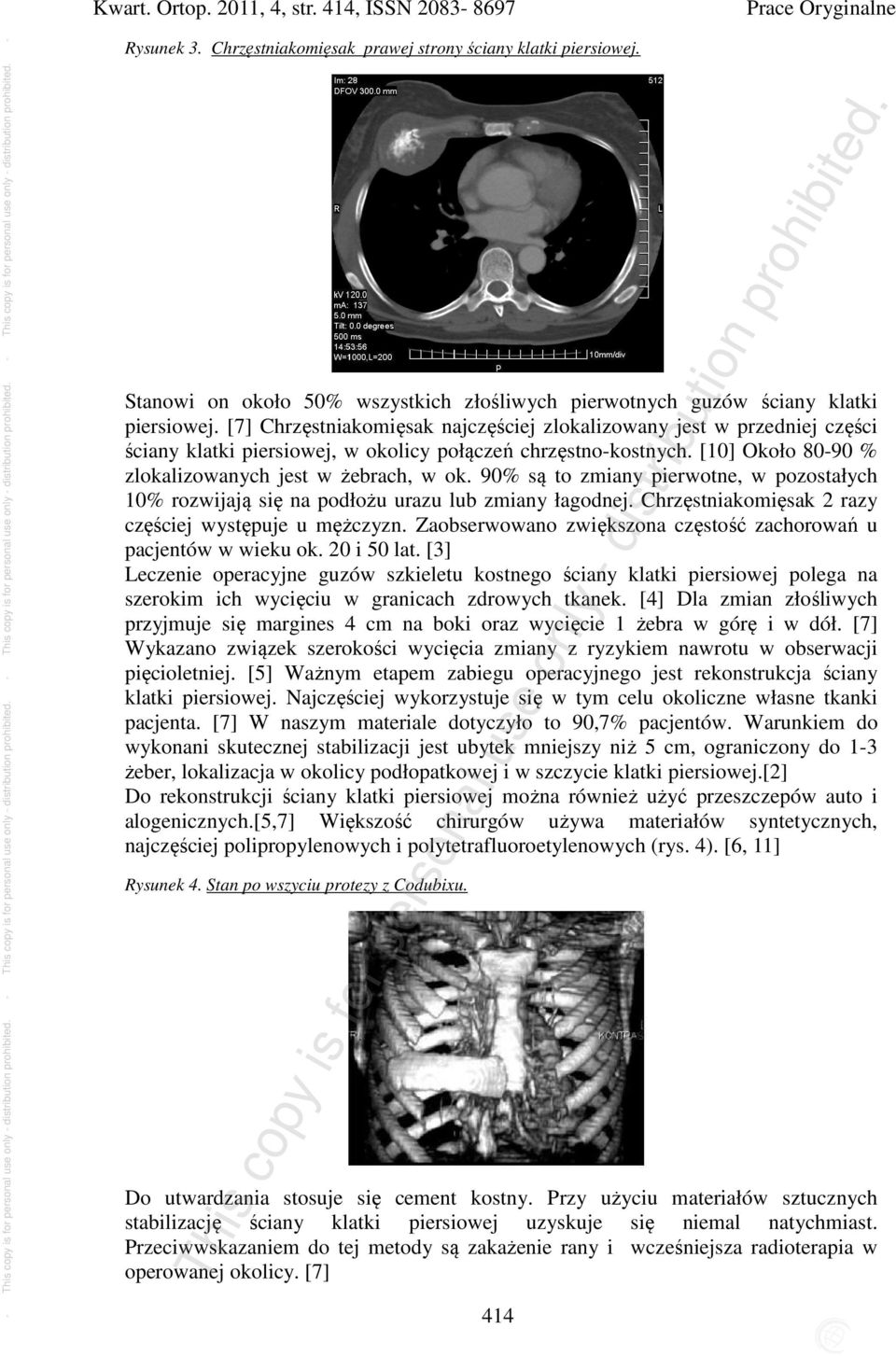 [7] Chrzęstniakomięsak najczęściej zlokalizowany jest w przedniej części ściany klatki piersiowej, w okolicy połączeń chrzęstno-kostnych. [0] Około 80-90 % zlokalizowanych jest w żebrach, w ok.