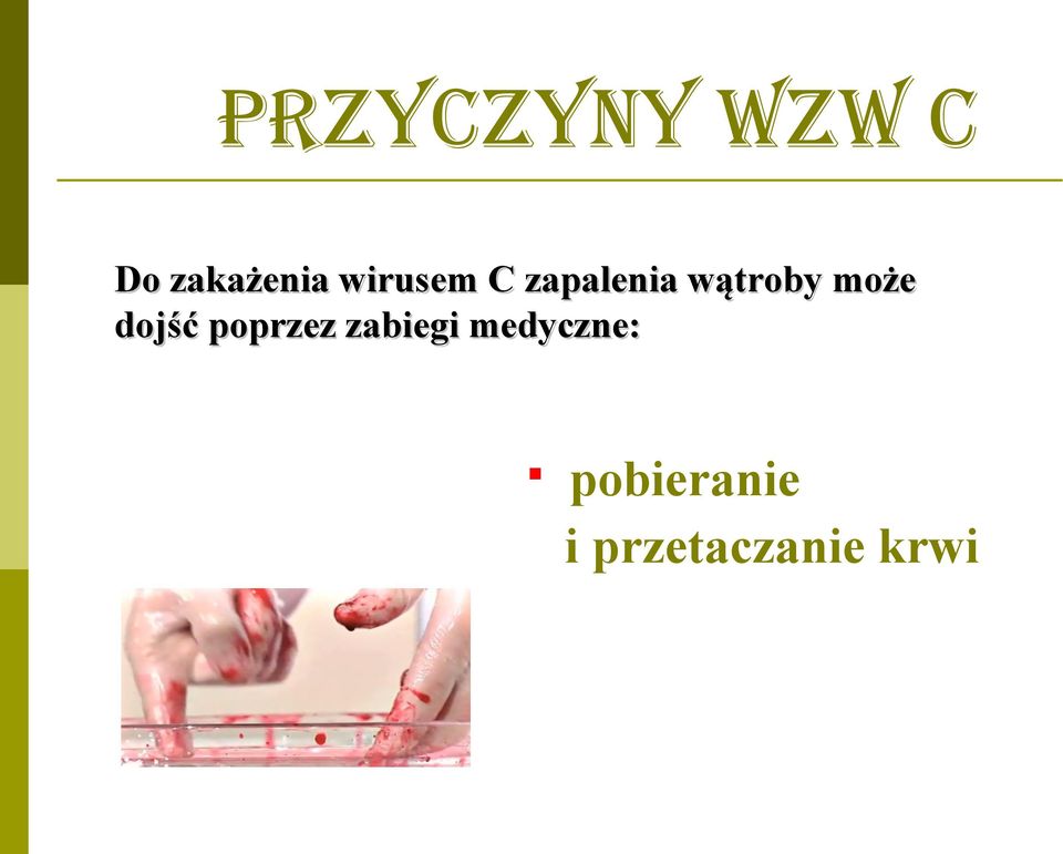 może dojść poprzez zabiegi