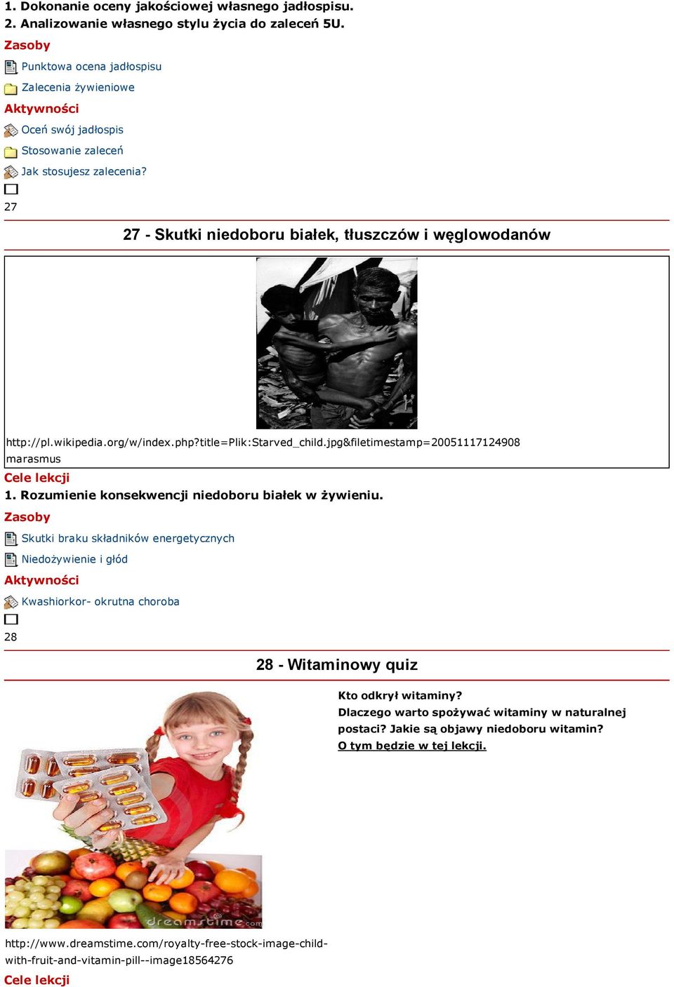 org/w/index.php?title=plik:starved_child.jpg&filetimestamp=20051117124908 marasmus 1. Rozumienie konsekwencji niedoboru białek w żywieniu.