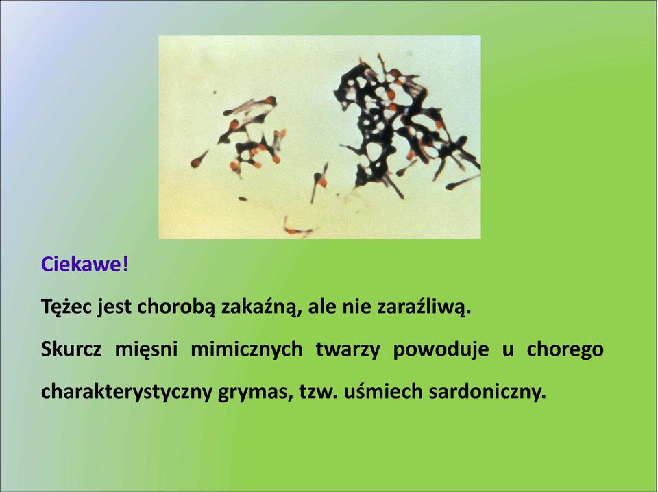 zaraźliwą.