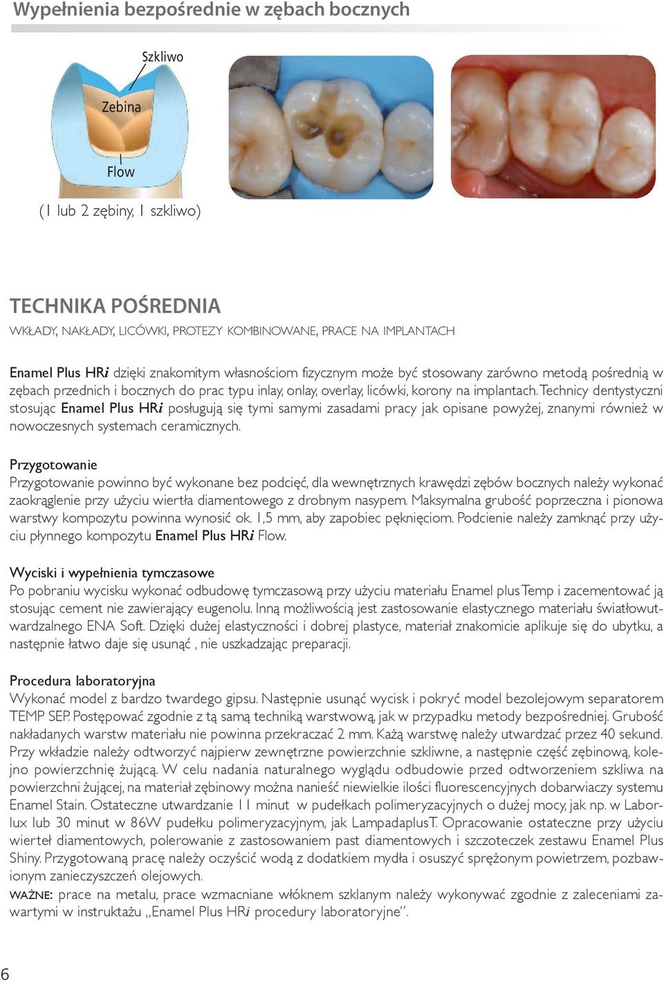 Technicy dentystyczni stosując Enamel Plus HRi posługują się tymi samymi zasadami pracy jak opisane powyżej, znanymi również w nowoczesnych systemach ceramicznych.