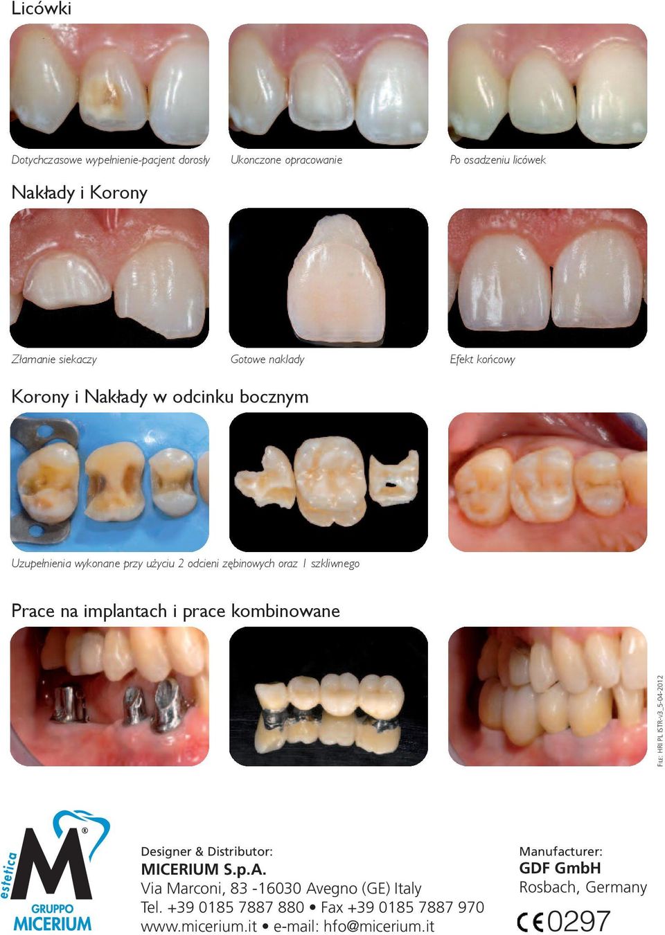 na implantach i prace kombinowane FILE: HRI PL ISTR-V3_5-04-2012 Designer & Distributor: MICERIUM S.p.A.