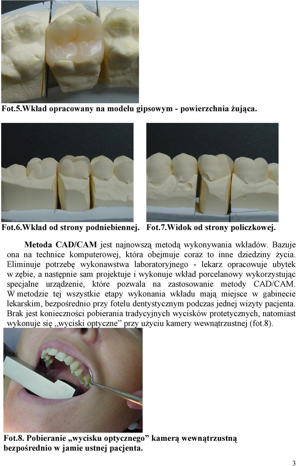 Eliminuje potrzebę wykonawstwa laboratoryjnego - lekarz opracowuje ubytek w zębie, a następnie sam projektuje i wykonuje wkład porcelanowy wykorzystując specjalne urządzenie, które pozwala na