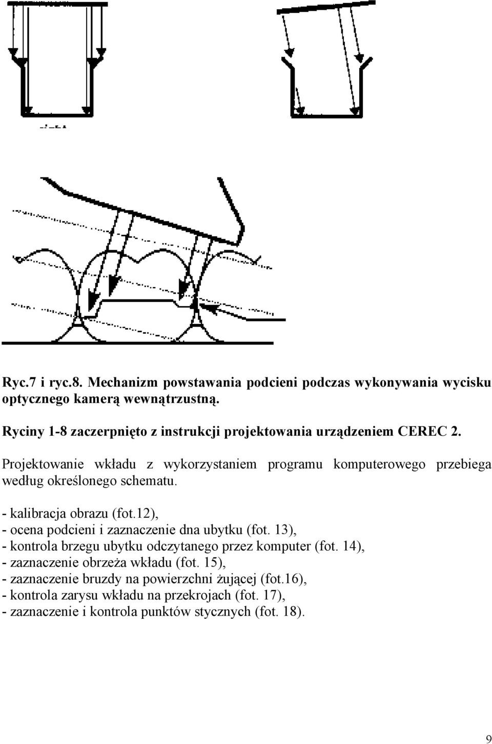 Projektowanie wkładu z wykorzystaniem programu komputerowego przebiega według określonego schematu. - kalibracja obrazu (fot.