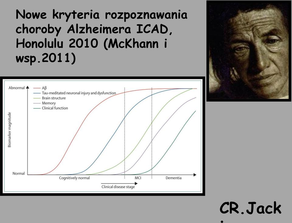 Alzheimera ICAD,