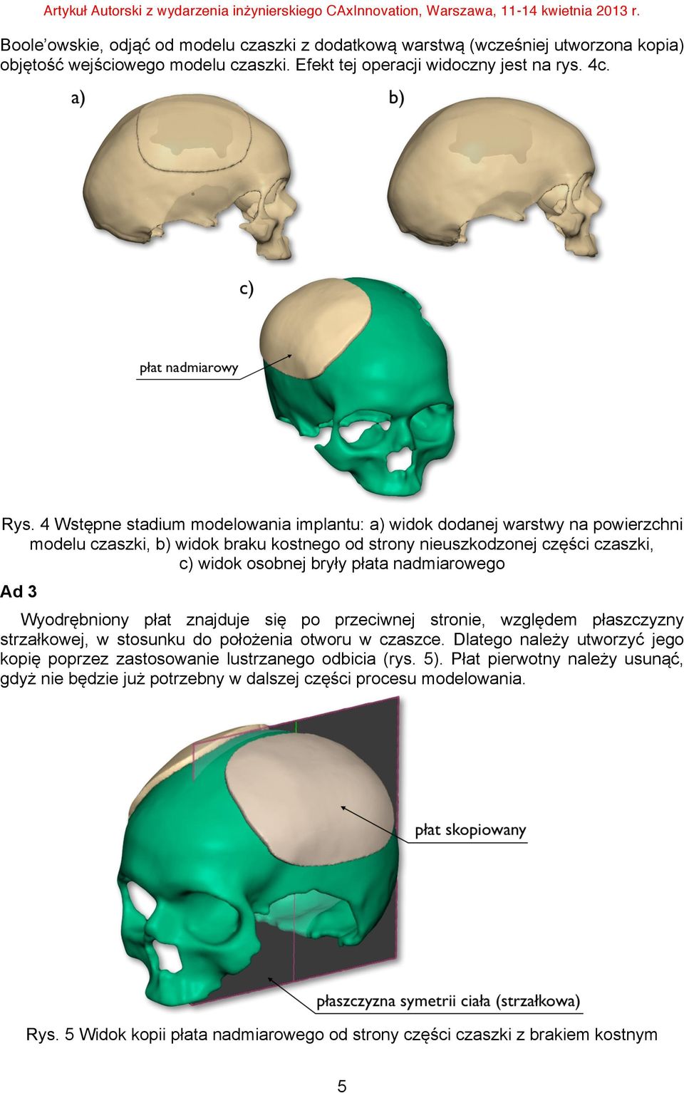 nadmiarowego Ad 3 Wyodrębniony płat znajduje się po przeciwnej stronie, względem płaszczyzny strzałkowej, w stosunku do położenia otworu w czaszce.