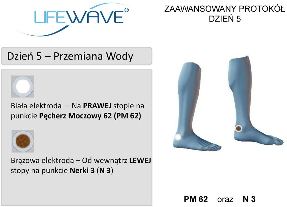 Pęcherz Moczowy 62 (PM 62) Brązowa elektroda Od