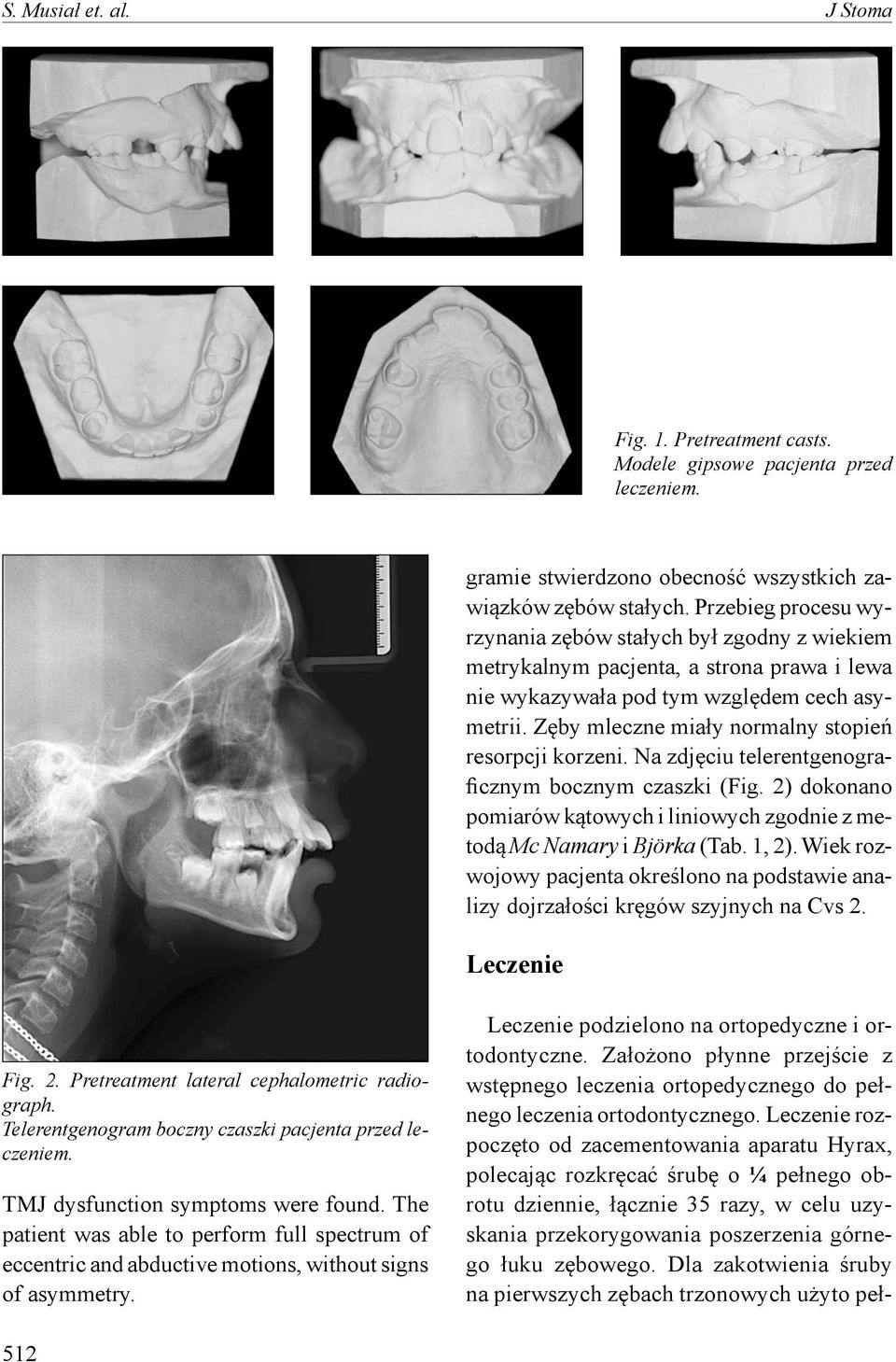 Zęby mleczne miały normalny stopień resorpcji korzeni. Na zdjęciu telerentgenograficznym bocznym czaszki (Fig. 2) dokonano pomiarów kątowych i liniowych zgodnie z metodą Mc Namary i Björka (Tab.