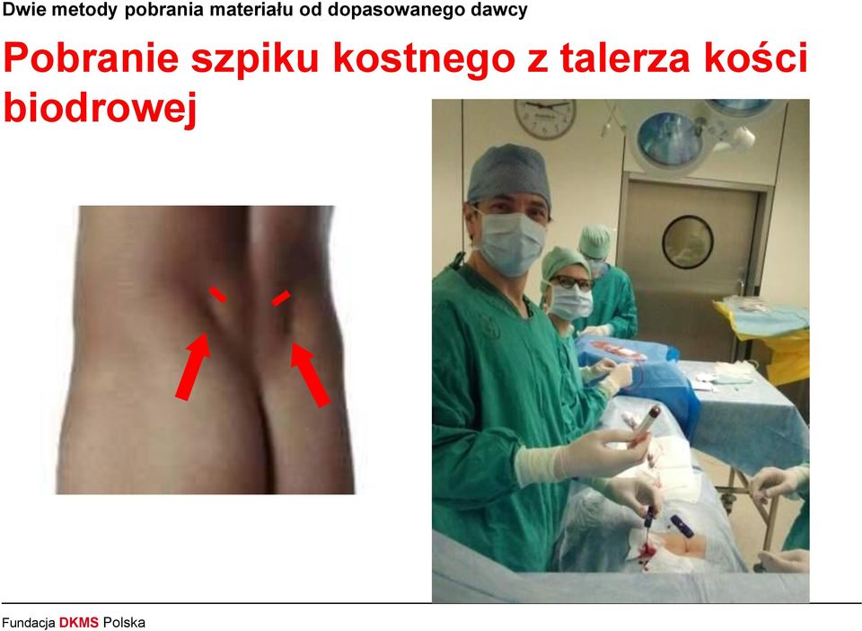 dawcy Pobranie szpiku