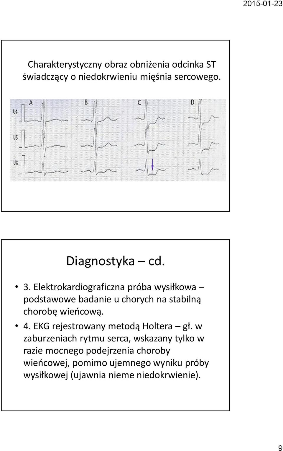 Elektrokardiograficzna próba wysiłkowa podstawowe badanie u chorych na stabilną chorobę wieńcową. 4.