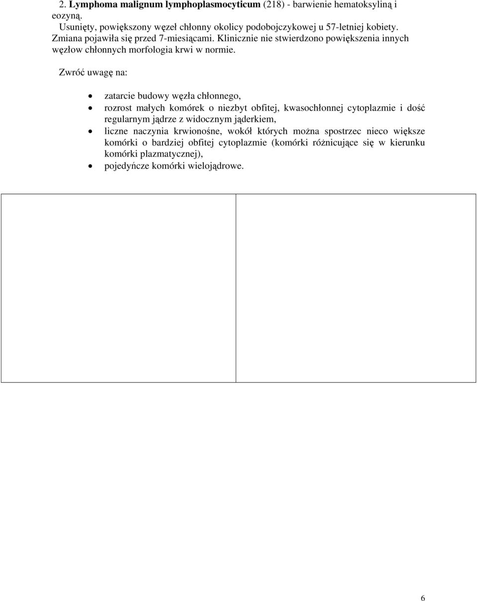 Zwróć uwagę na: zatarcie budowy węzła chłonnego, rozrost małych komórek o niezbyt obfitej, kwasochłonnej cytoplazmie i dość regularnym jądrze z widocznym jąderkiem,