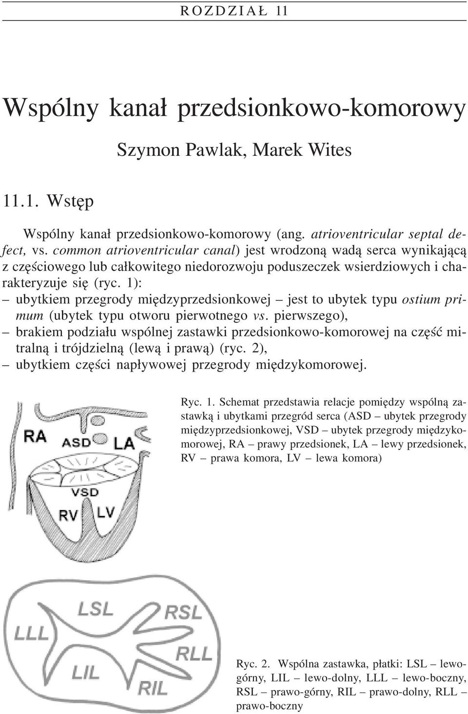1): ubytkiem przegrody miêdzyprzedsionkowej jest to ubytek typu ostium primum (ubytek typu otworu pierwotnego vs.