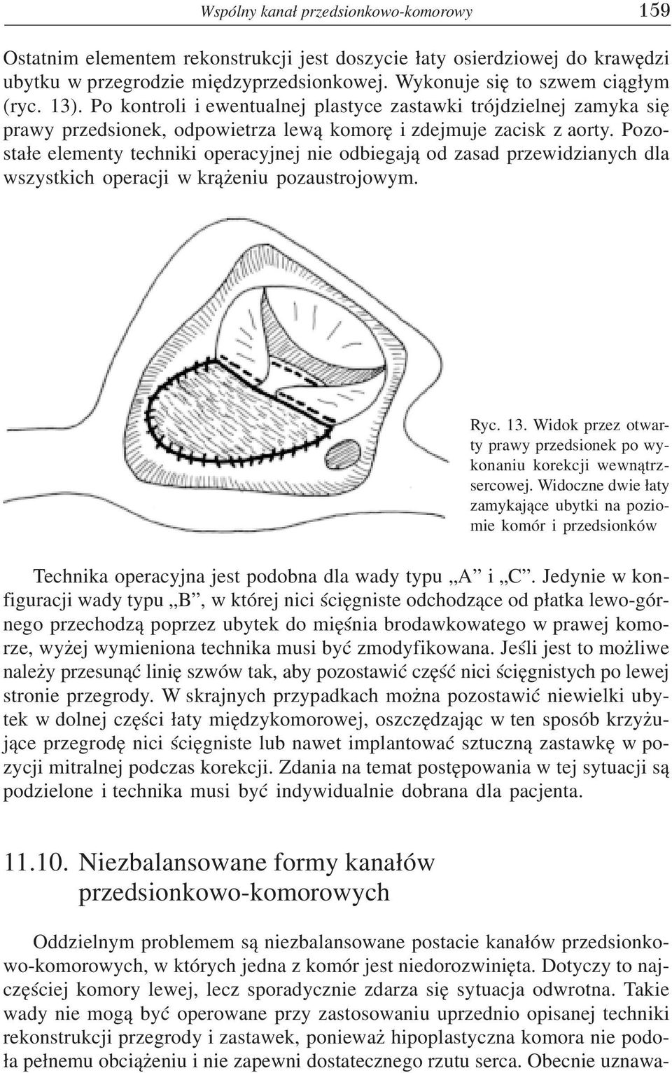 Pozosta³e elementy techniki operacyjnej nie odbiegaj¹ od zasad przewidzianych dla wszystkich operacji w kr¹ eniu pozaustrojowym. Ryc. 13.