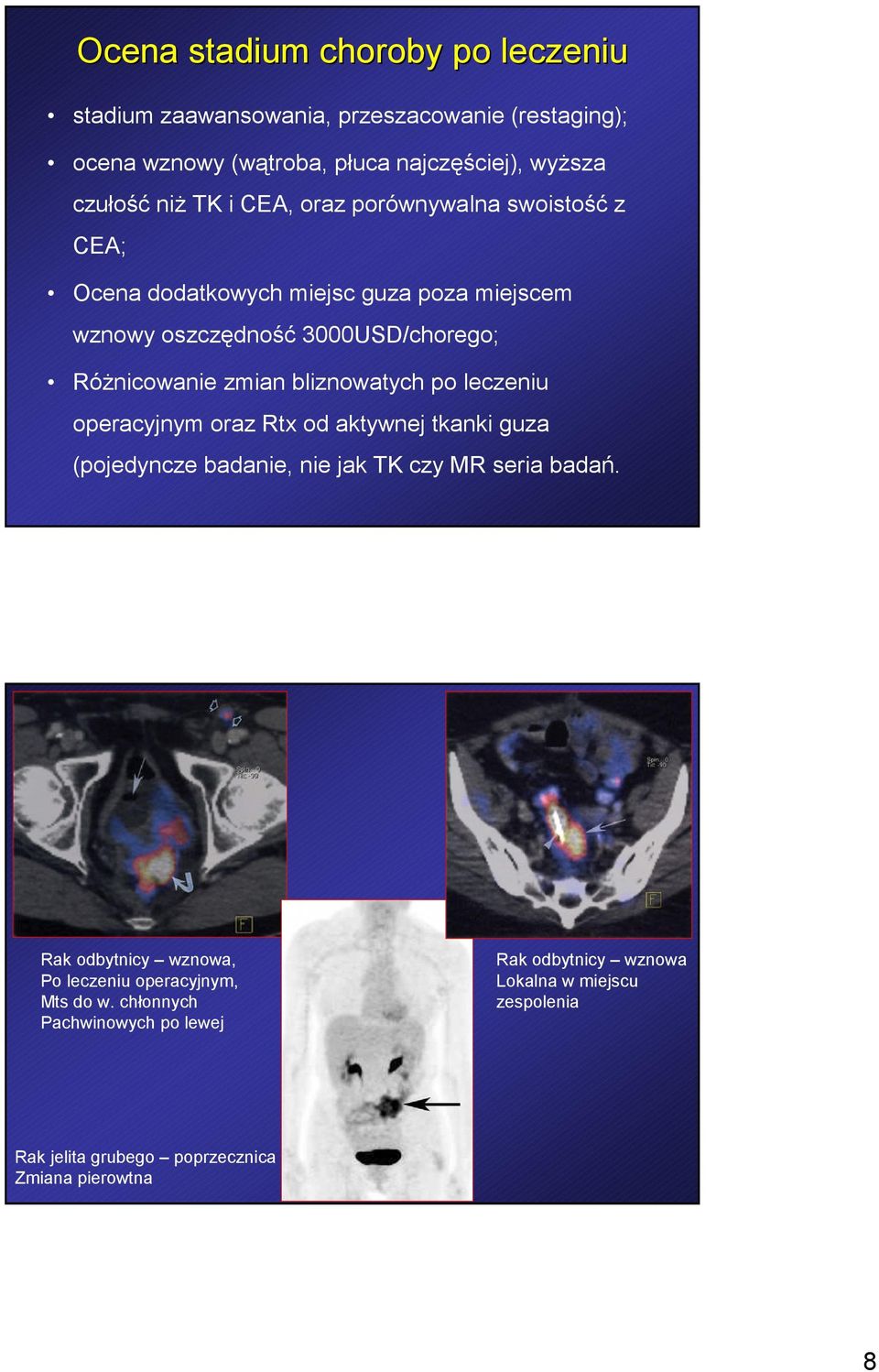 bliznowatych po leczeniu operacyjnym oraz Rtx od aktywnej tkanki guza (pojedyncze badanie, nie jak TK czy MR seria badań.