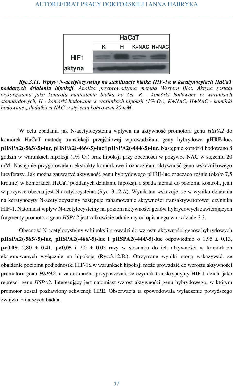 K - komórki hodowane w warunkach standardowych, H - komórki hodowane w warunkach hipoksji (1% O 2), K+NAC, H+NAC - komórki hodowane z dodatkiem NAC w stężeniu końcowym 20 mm.