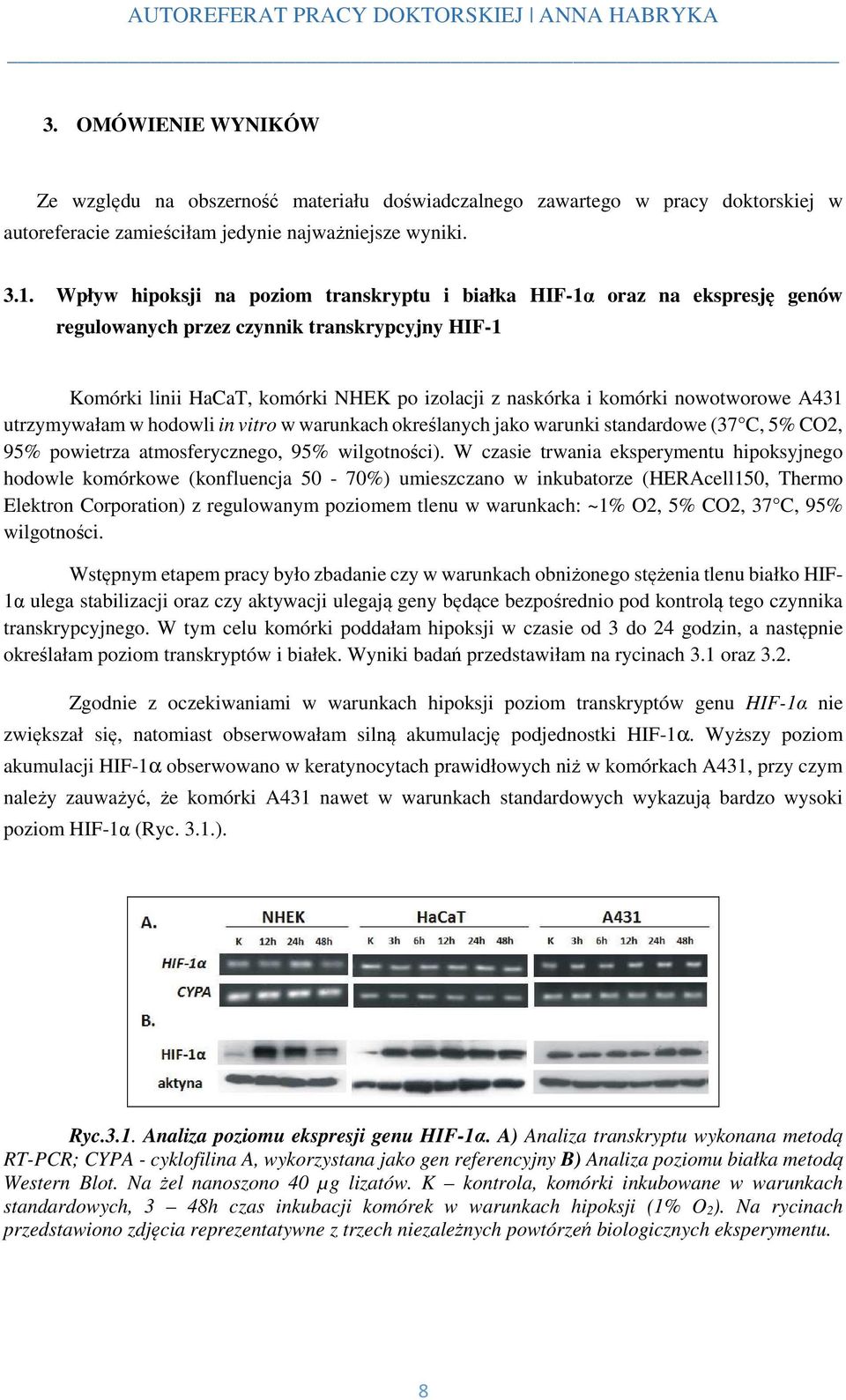 nowotworowe A431 utrzymywałam w hodowli in vitro w warunkach określanych jako warunki standardowe (37 C, 5% CO2, 95% powietrza atmosferycznego, 95% wilgotności).