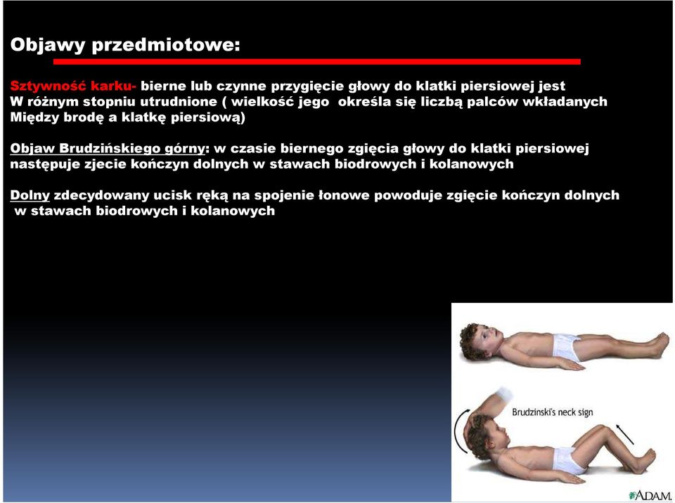 górny: w czasie biernego zgięcia głowy do klatki piersiowej następuje zjecie kończyn dolnych w stawach biodrowych i