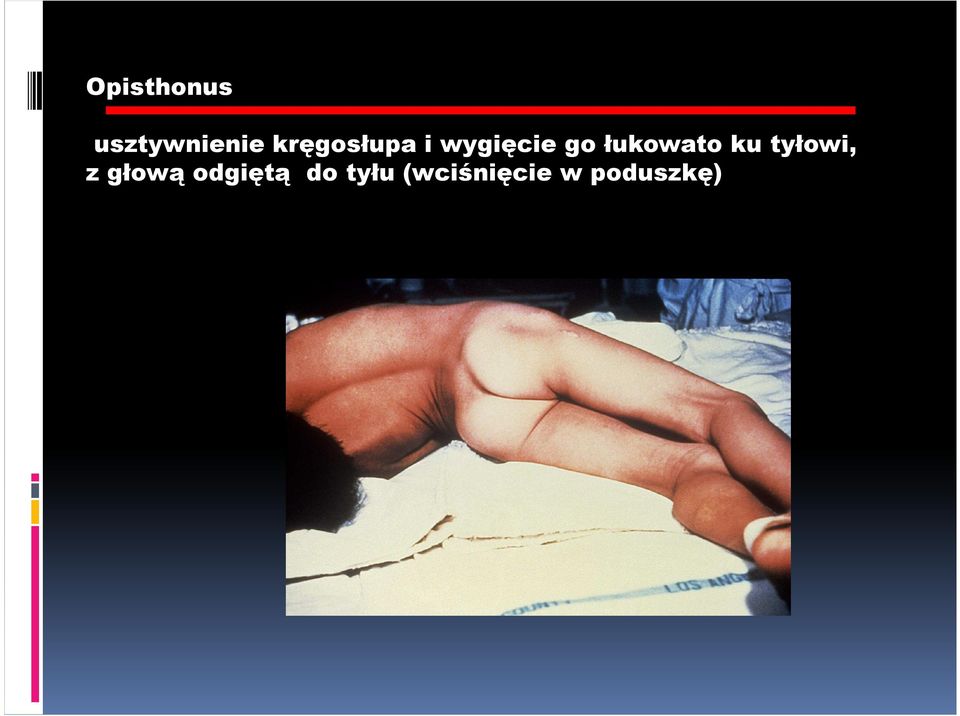 łukowato ku tyłowi, z głową