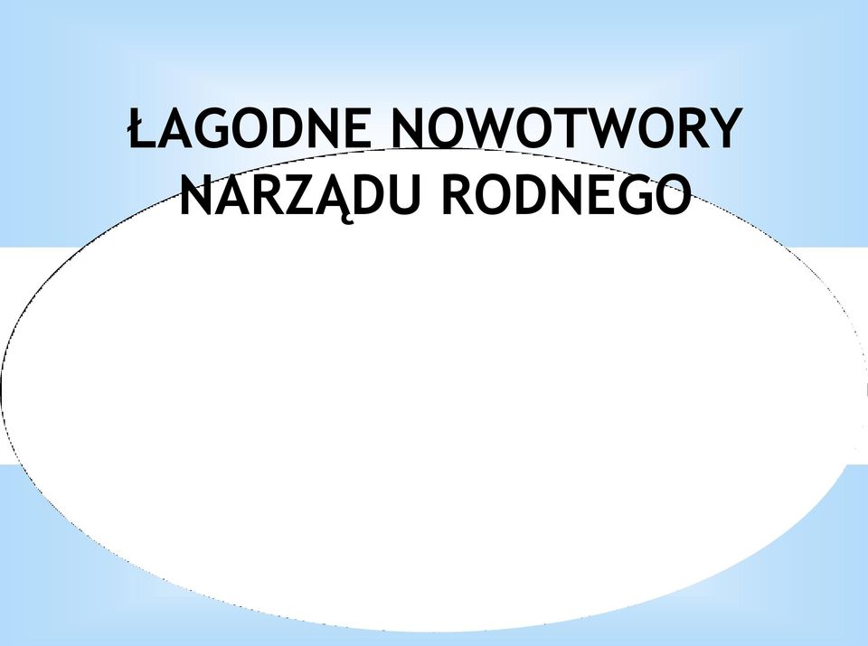 NARZĄDU