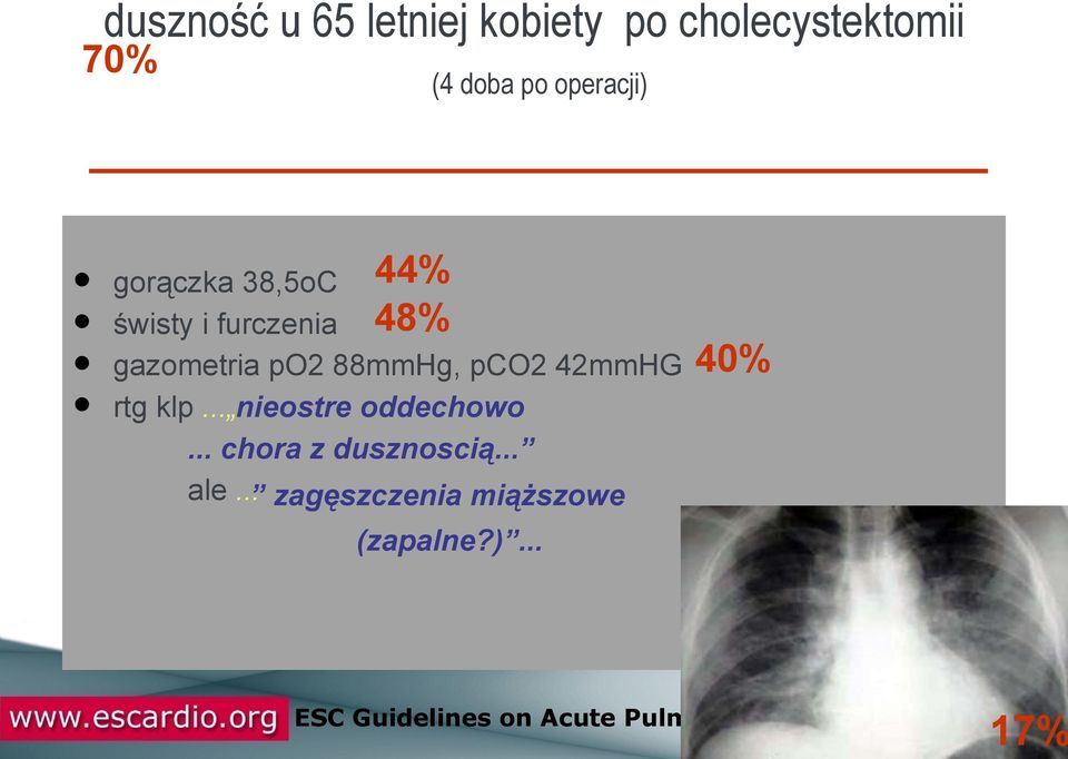 42mmHG rtg klp... nieostre oddechowo... chora z dusznoscią... ale.