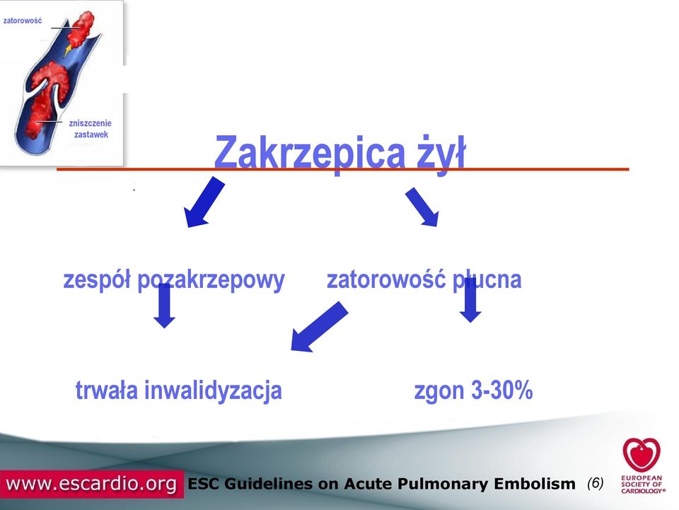 trwała inwalidyzacja zatorowość płucna