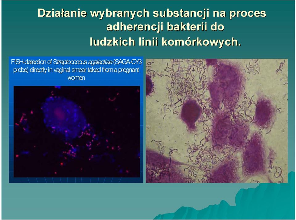 FISH-detection of Streptococcus agalactiae (SAGA-CY3