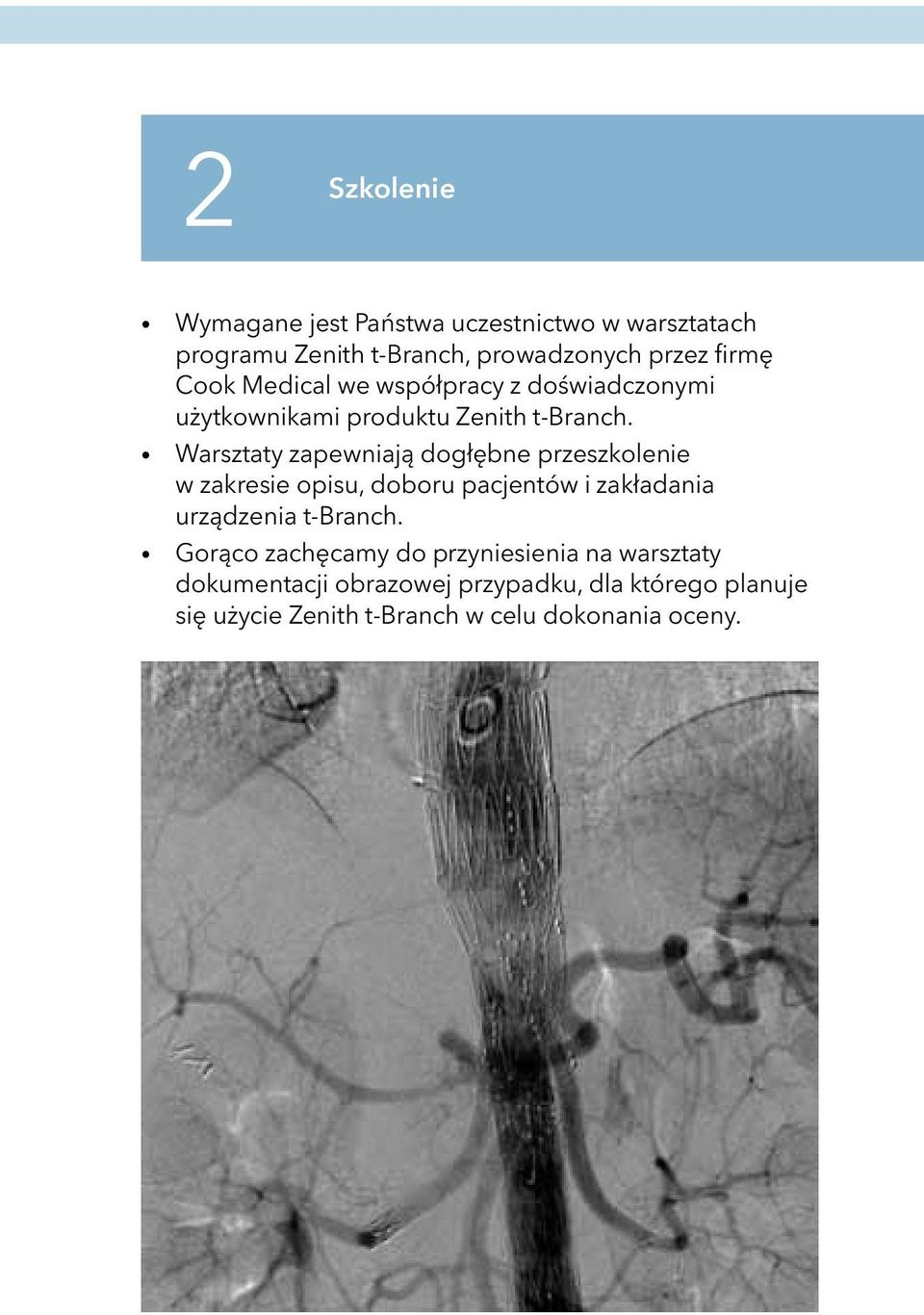 Warsztaty zapewniają dogłębne przeszkolenie w zakresie opisu, doboru pacjentów i zakładania urządzenia t-branch.