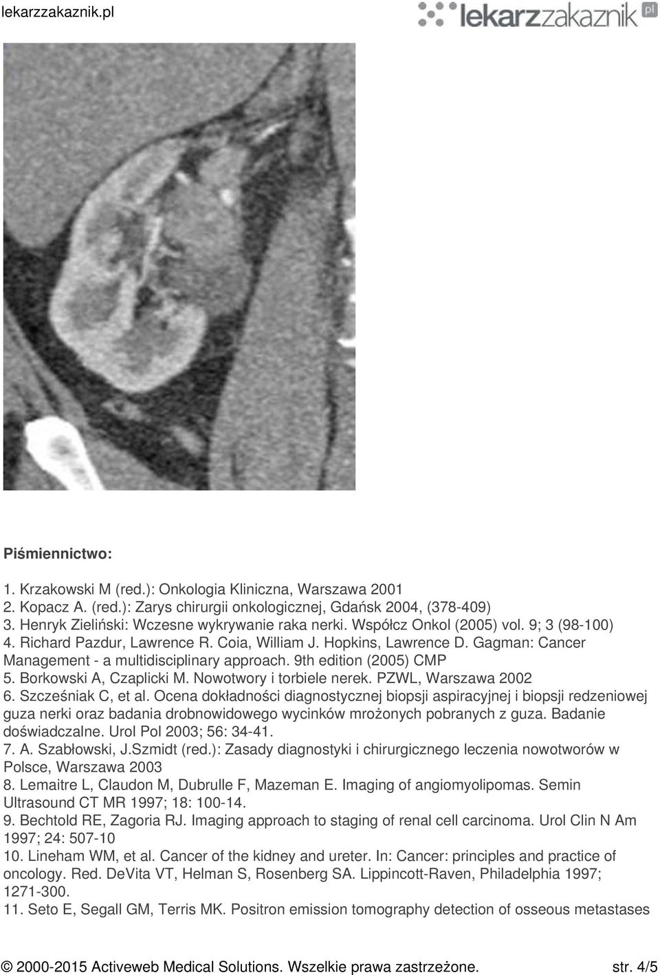 Borkowski A, Czaplicki M. Nowotwory i torbiele nerek. PZWL, Warszawa 2002 6. Szcześniak C, et al.