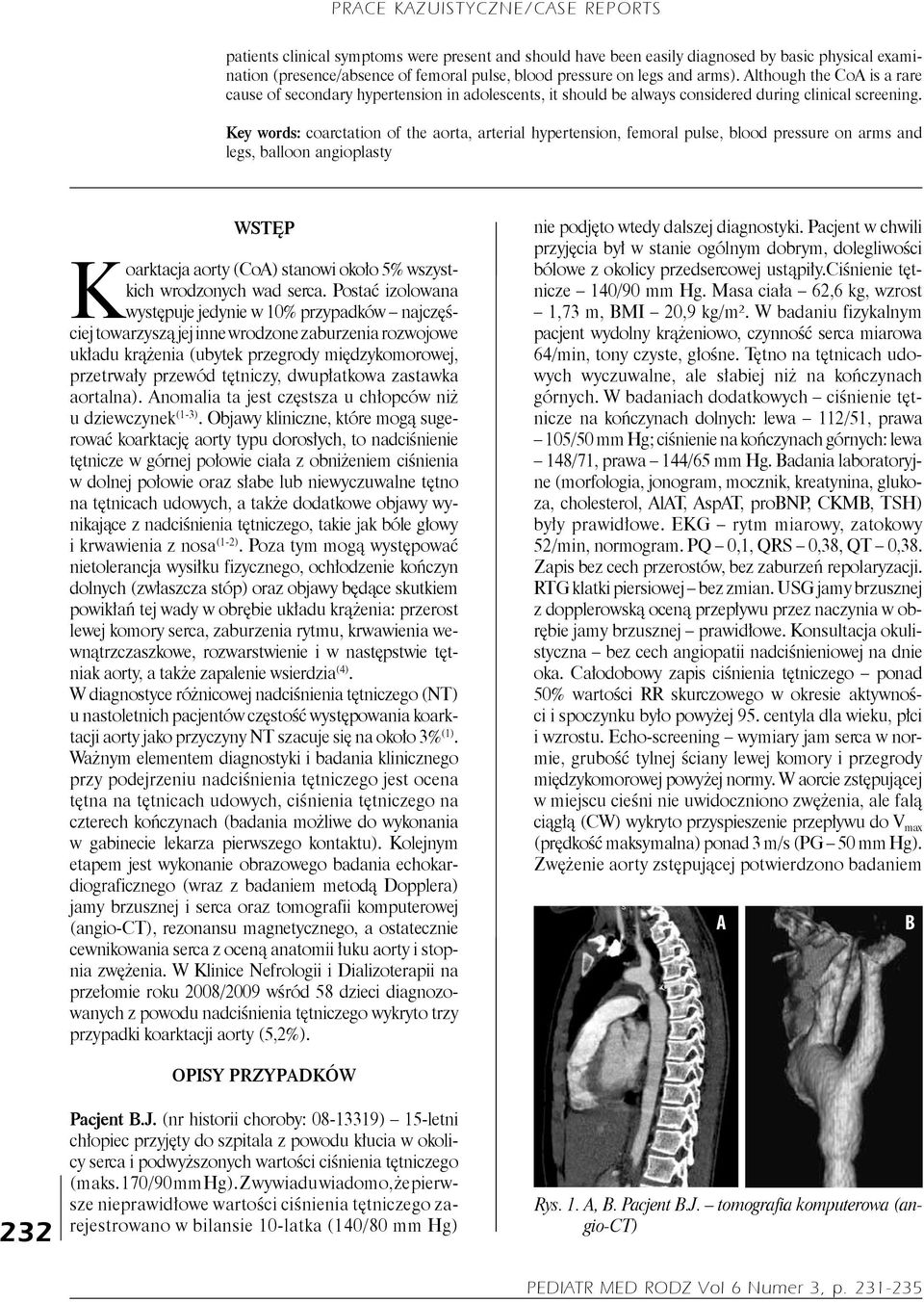 Key words: coarctation of the aorta, arterial hypertension, femoral pulse, blood pressure on arms and legs, balloon angioplasty WSTĘP Koarktacja aorty (o) stanowi około 5% wszystkich wrodzonych wad