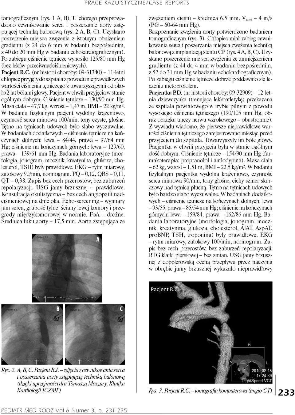 Po zabiegu ciśnienie tętnicze wynosiło 125/80 mm Hg (bez leków przeciwnadciśnieniowych). Pacjent R.