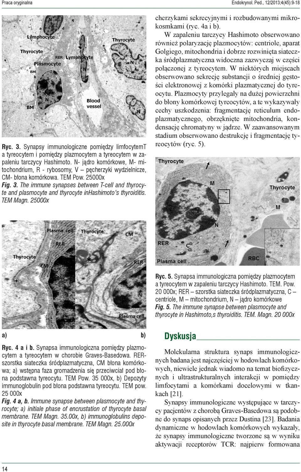 The immune synapses between T-cell and thyrocyte and plasmocyte and thyrocyte inhashimoto s thyroiditis. TEM Magn. 25000x cherzykami sekrecyjnymi i rozbudowanymi mikrokosmkami (ryc. 4a i b).