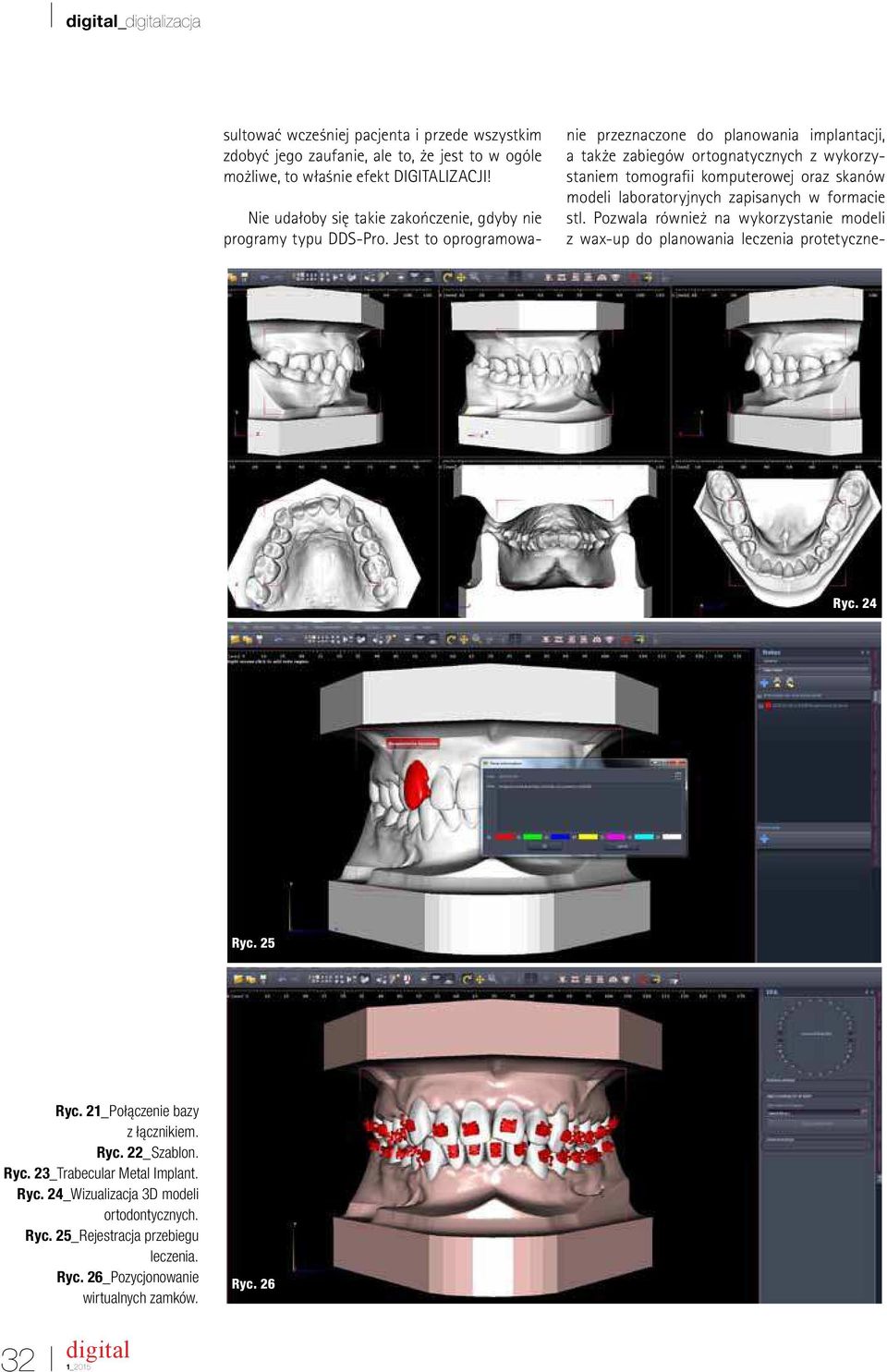 Jest to oprogramowanie przeznaczone do planowania implantacji, a także zabiegów ortognatycznych z wykorzystaniem tomograii komputerowej oraz skanów modeli laboratoryjnych zapisanych w