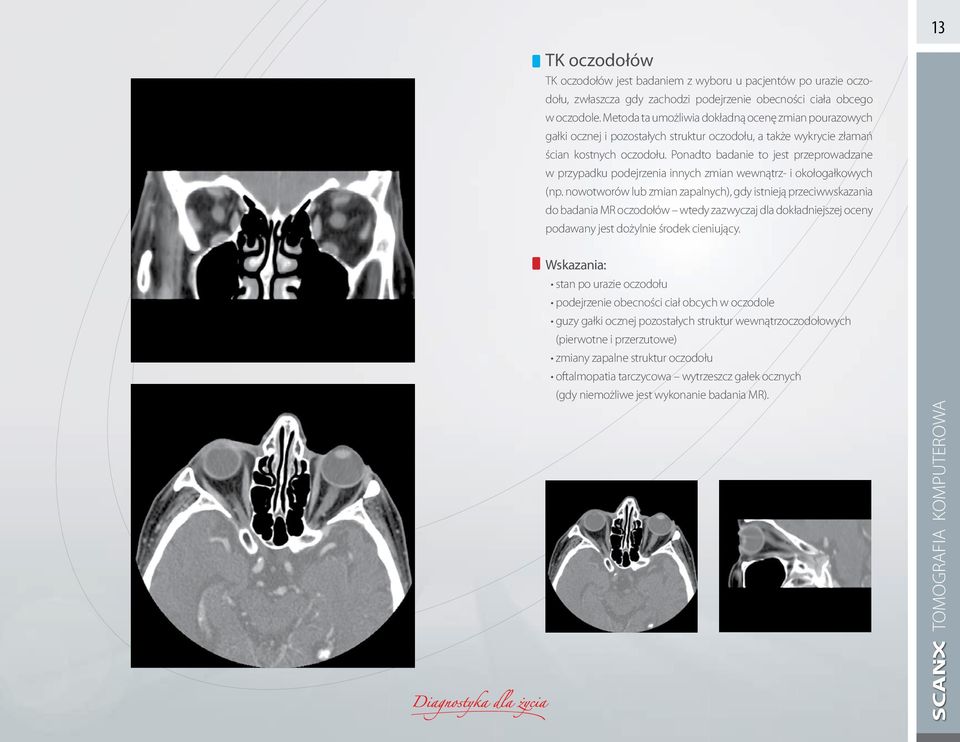 Ponadto badanie to jest przeprowadzane w przypadku podejrzenia innych zmian wewnątrz- i okołogałkowych (np.