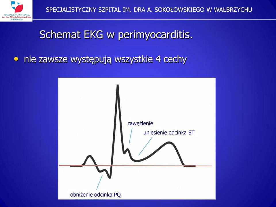 4 cechy zawęźlenie uniesienie