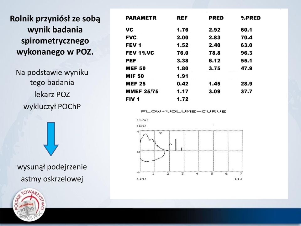 83 70.4 - nieprawidłowa krzywa FEV 1 1.52 2.40 63.0 - spirometria bez MIF odwracalności 50 1.91 FEV 1%VC 76.0 78.8 96.3 PEF 3.38 6.