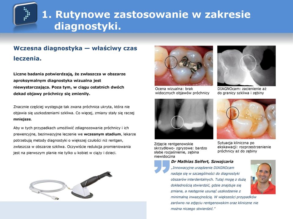 Ocena wizualna: brak widocznych objawów próchnicy DIAGNOcam: zacienienie aż do granicy szkliwa i zębiny Znacznie częściej występuje tak zwana próchnica ukryta, która nie objawia się uszkodzeniami