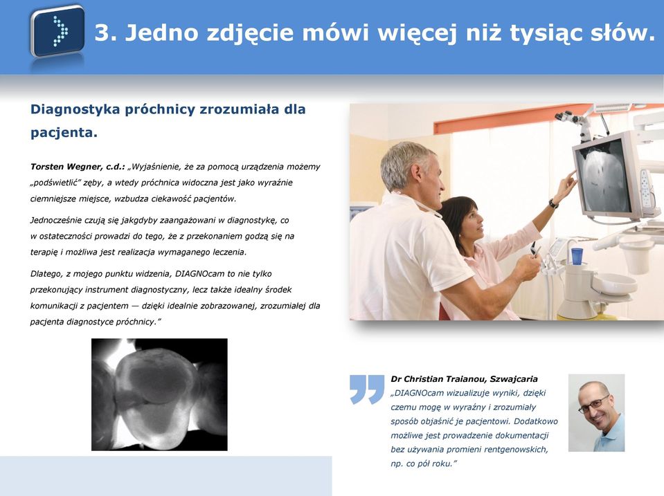 Dlatego, z mojego punktu widzenia, DIAGNOcam to nie tylko przekonujący instrument diagnostyczny, lecz także idealny środek komunikacji z pacjentem dzięki idealnie zobrazowanej, zrozumiałej dla