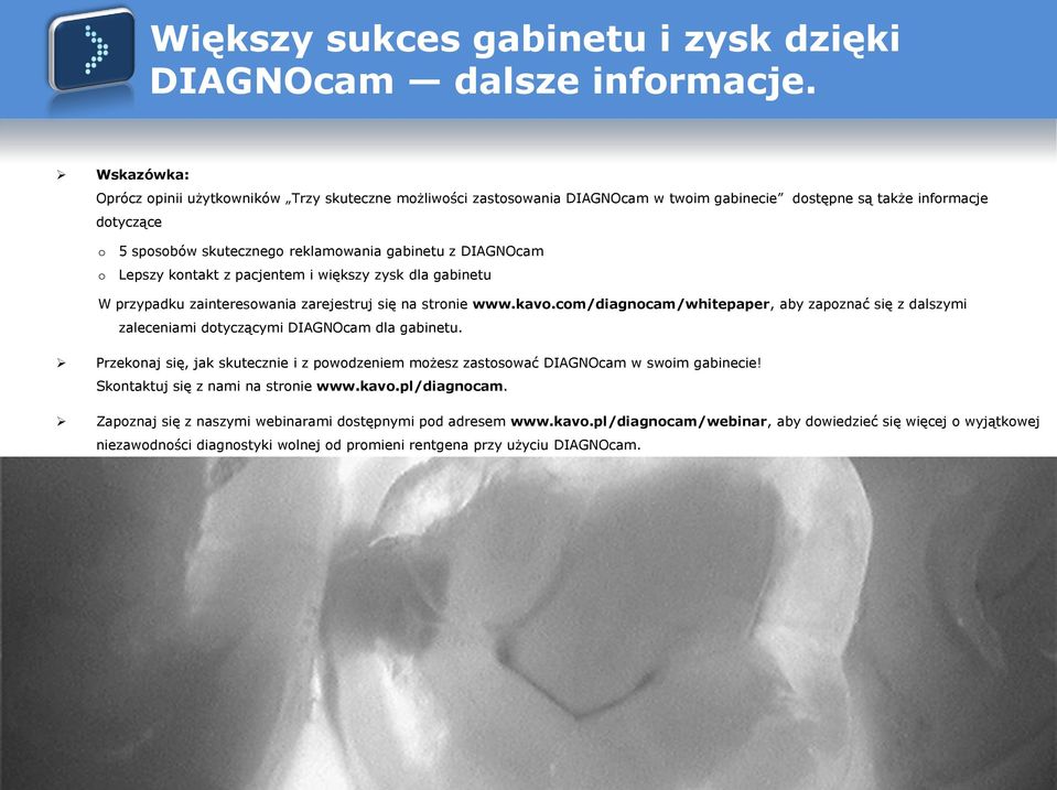 DIAGNOcam Lepszy kontakt z pacjentem i większy zysk dla gabinetu W przypadku zainteresowania zarejestruj się na stronie www.kavo.