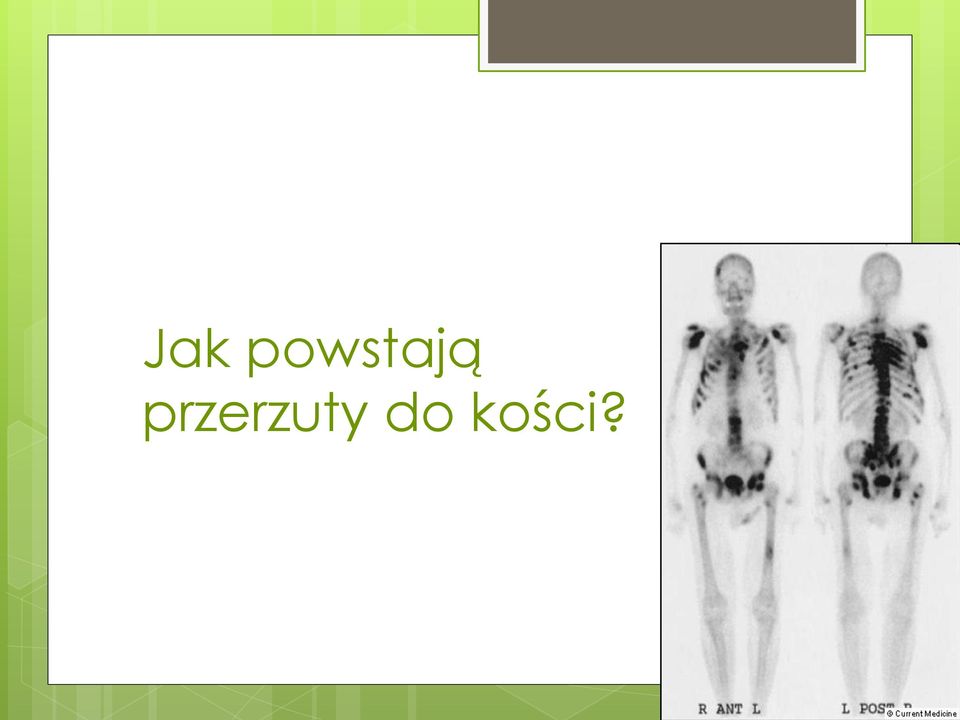przerzuty