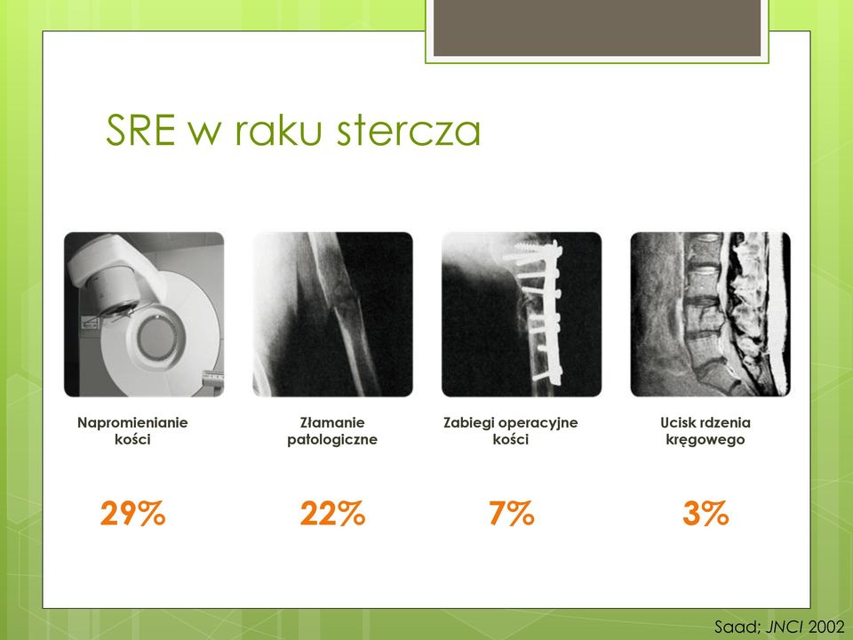 Zabiegi operacyjne kości Ucisk