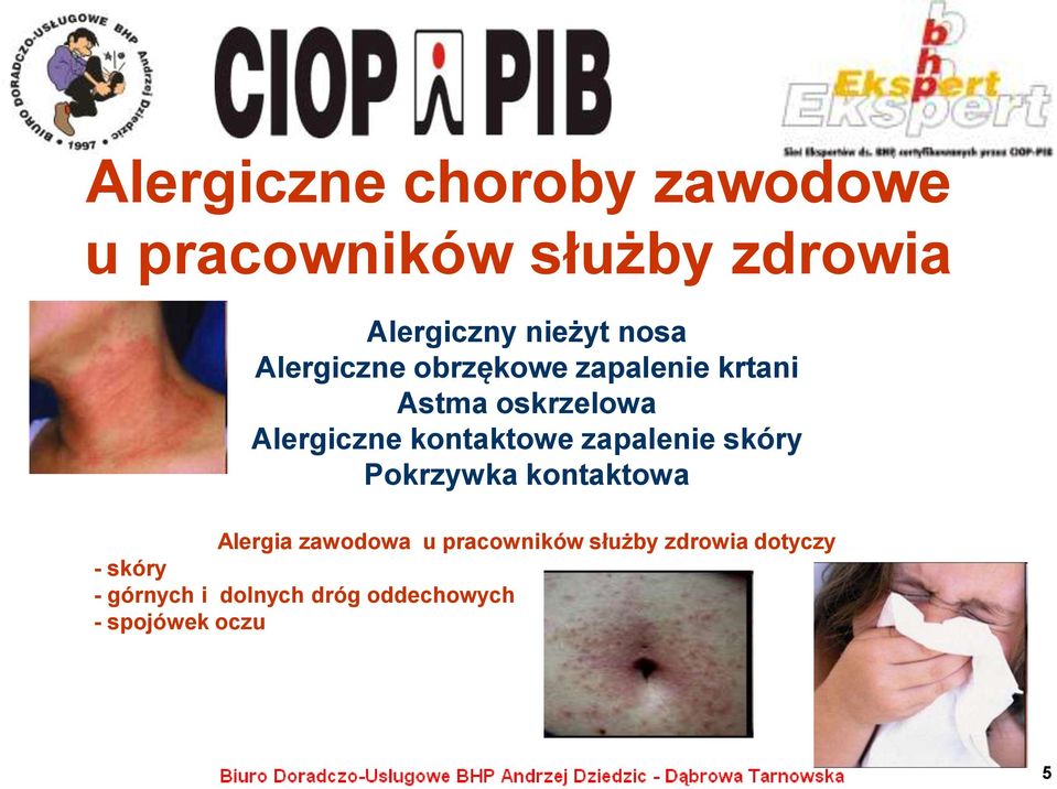 kontaktowe zapalenie skóry Pokrzywka kontaktowa Alergia zawodowa u