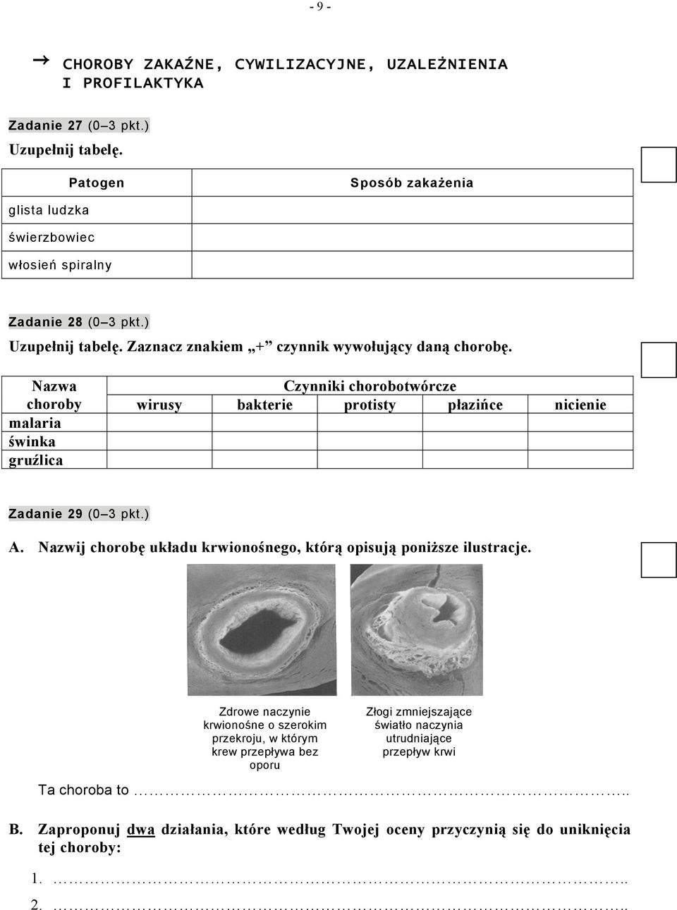 Nazwa choroby malaria świnka gruźlica Czynniki chorobotwórcze wirusy bakterie protisty płazińce nicienie Zadanie 9 (0 3 pkt.) A.