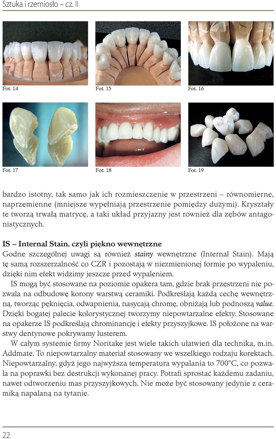 Kryształy te tworzą trwałą matrycę, a taki układ przyjazny jest również dla zębów antagonistycznych.